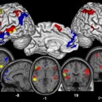 actividad_cerebral