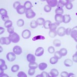 plasmodium