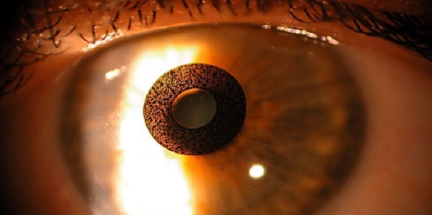ojocornea